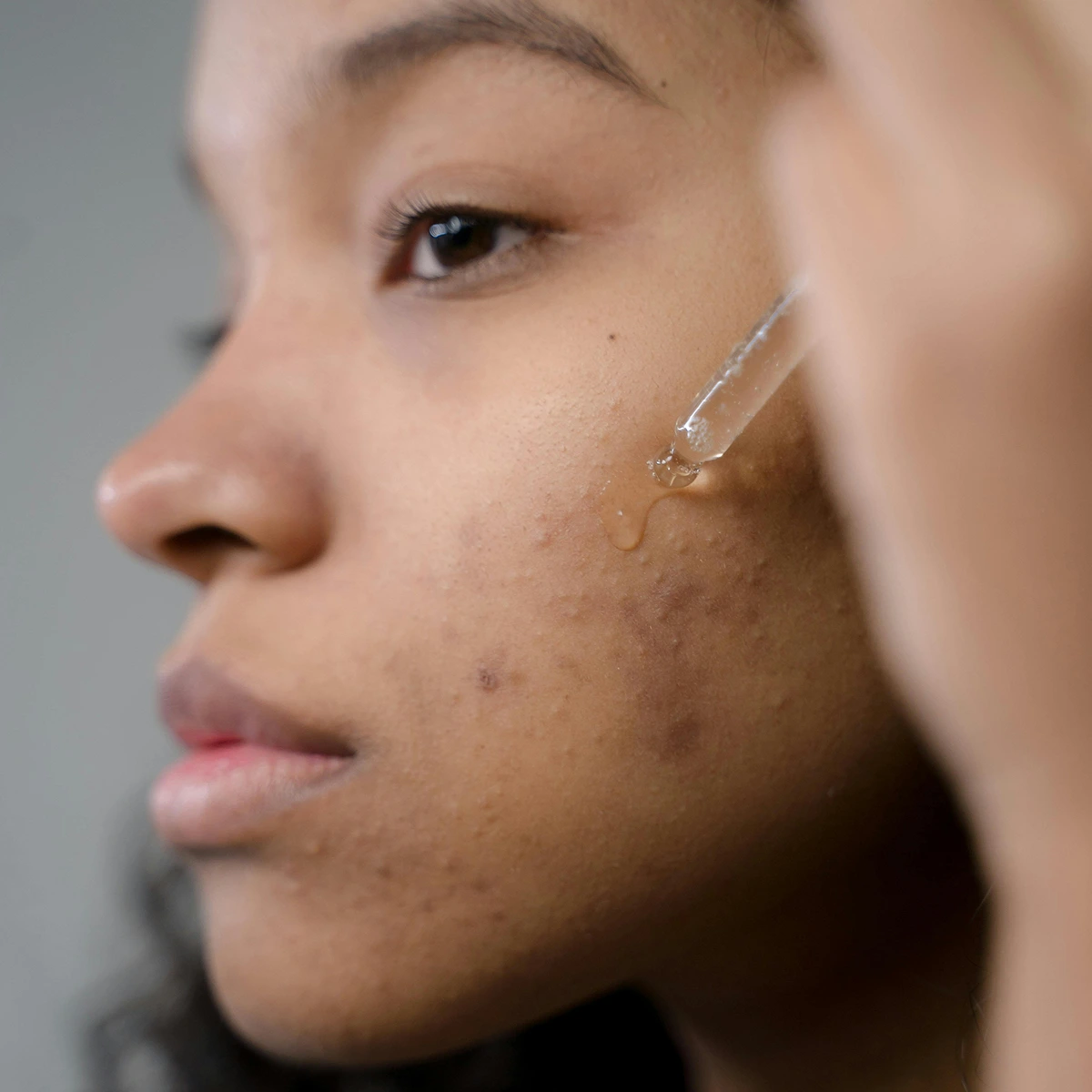 Sérum Exfoliant Anti-Imperfections PERFECT+ – Image 3